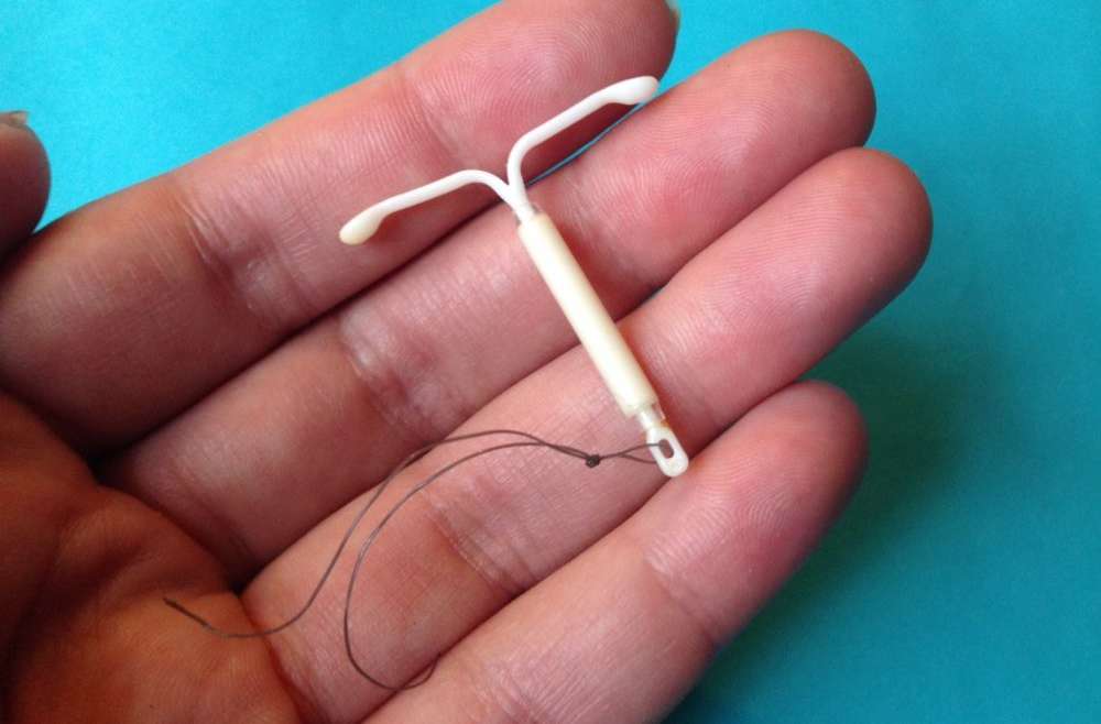 IUD placement