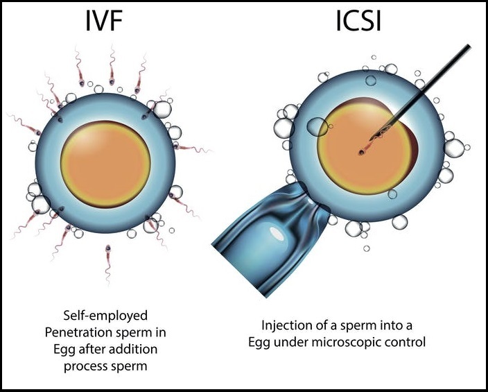 IVF Treatment Center In Mumbai | IVF Treatment In Kandivali