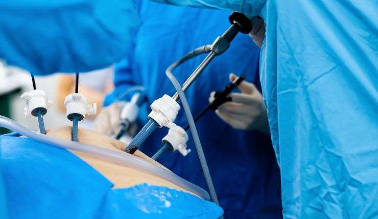 laparoscopic surgery in Mumbai