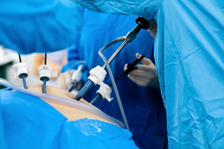 laparoscopic surgery in Mumbai