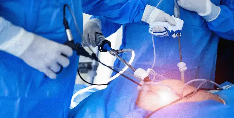 Laparoscopic Surgery in Mumbai