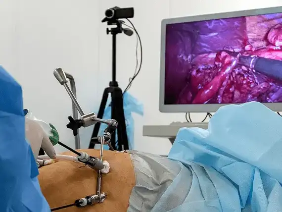 Laparoscopic Surgery in Mumbai