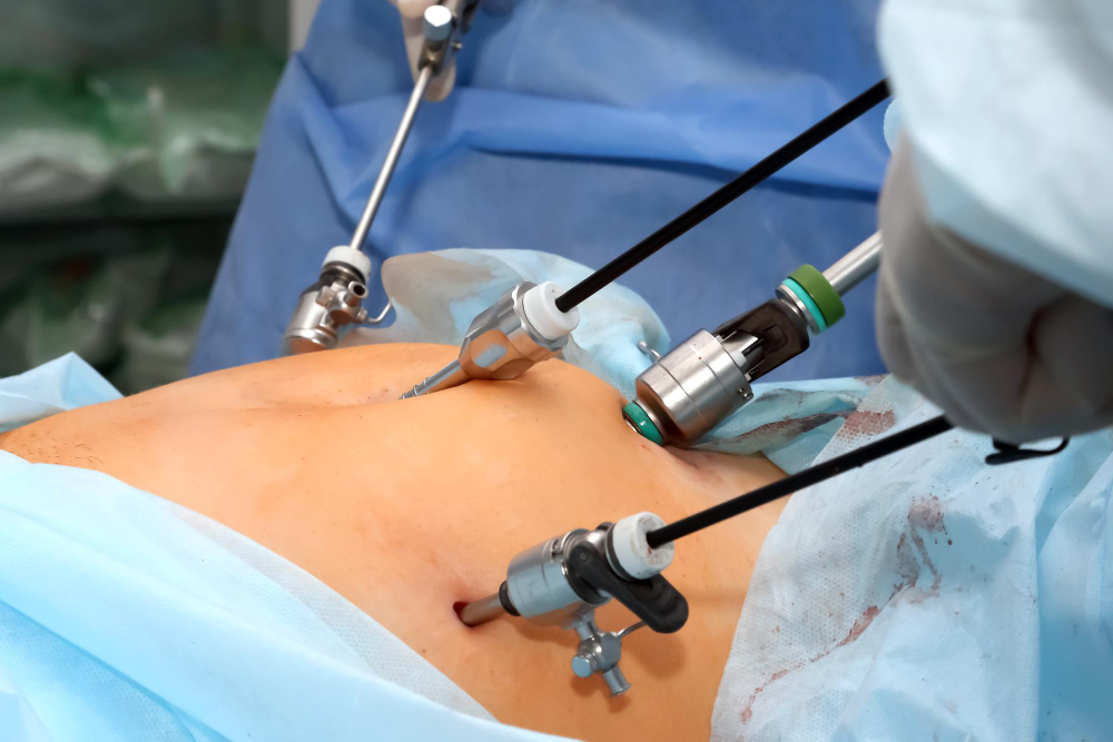 Laparoscopic Surgery in Mumbai