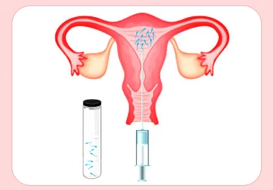 Best LUI Treatment in Kandivali West