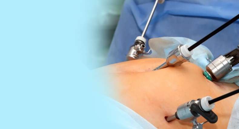 Best Laparoscopic Surgeon in Kandivali