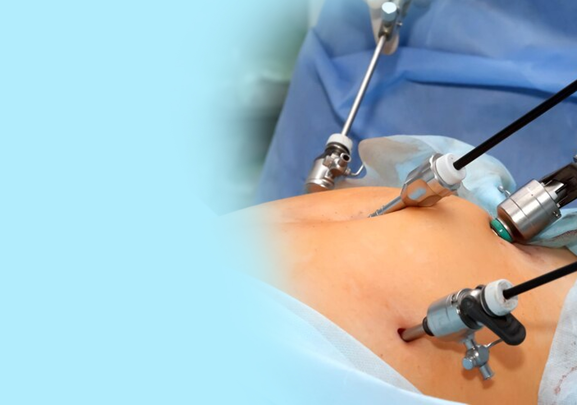 Best Laparoscopic Surgeon in Kandivali