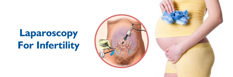 laparoscopic surgery in Mumbai
