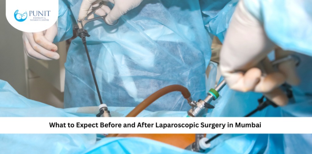 Laparoscopic Surgery in Mumbai